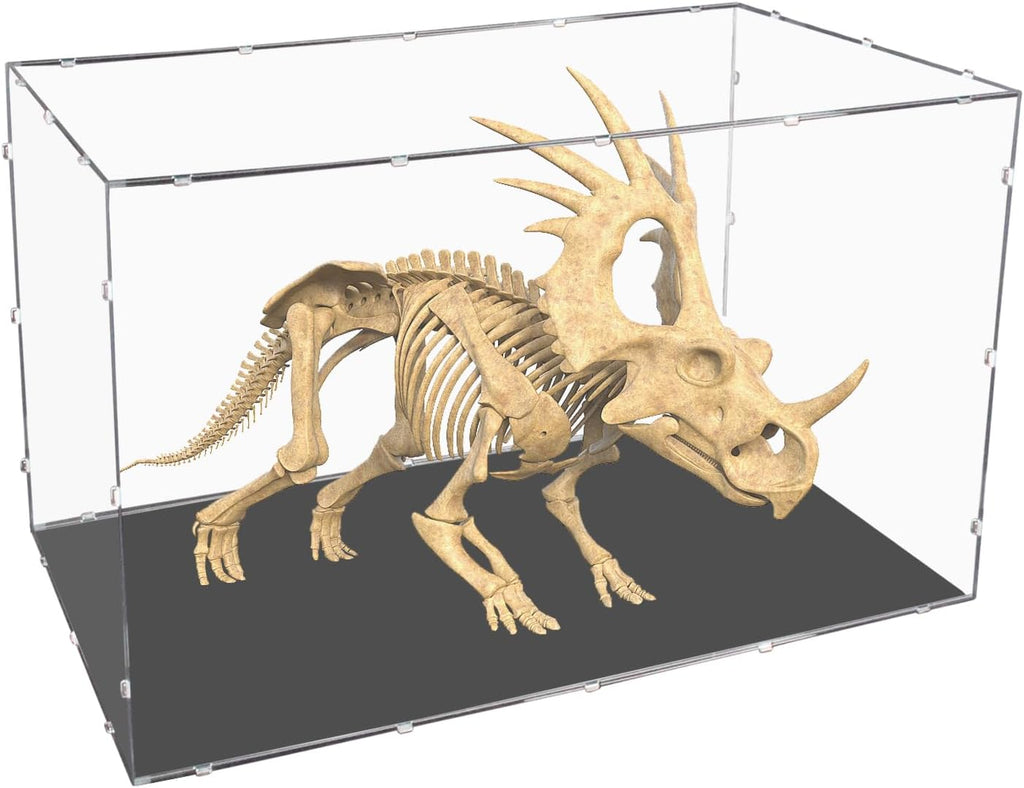 Evron Display Case for Collectibles Assemble Clear Acrylic Box Alternative Glass Case for Display Action Figures Home Storage & Organizing Toys (16x16x30 inch;41x41x76cm)